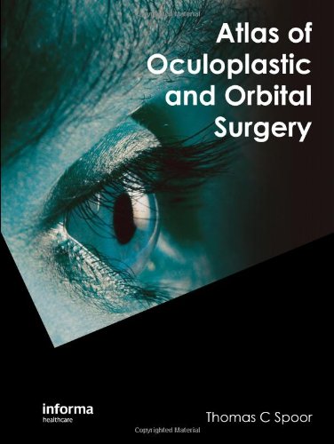Atlas Of Oculoplastic And Orbital Surgery 1st Edition Thomas C Spoor