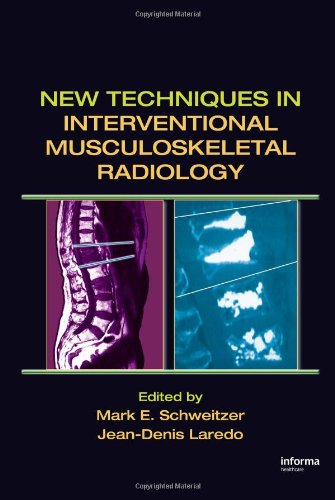 New Techniques In Interventional Musculoskeletal Radiology 1st Edition Mark E Schweitzer