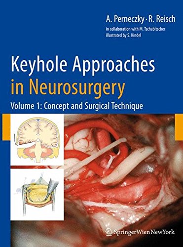 Keyhole Approaches In Neurosurgery Volume 1 Concept And Surgical Technique 1st Edition Axel Perneczky