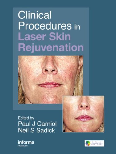Clinical Procedures In Laser Skin Rejuvenation Series In Cosmetic And Laser Therapy 1st Edition Paul Carniol