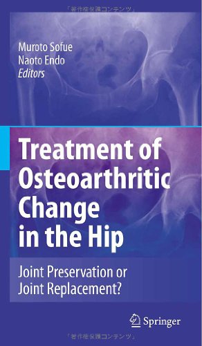 Treatment Of Osteoarthritic Change In The Hip Joint Preservation Or Joint Replacement 1st Edition M Sofue