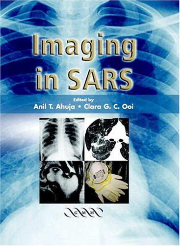 Imaging In Sars 1st Edition A T Ahuja C G C Ooi
