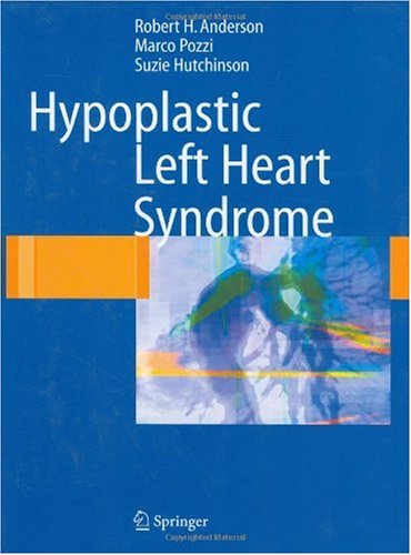 Hypoplastic Left Heart Syndrome 1st Edition Robert H Anderson