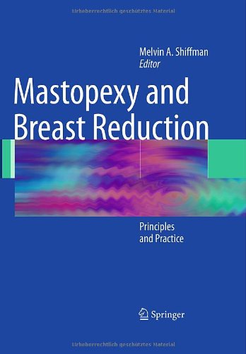 Mastopexy And Breast Reduction Principles And Practice 1st Edition Michael R Davis Auth