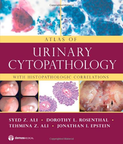 Atlas Of Urinary Cytopathology With Histopathologic Correlations 1st Edition Syed Z Ali