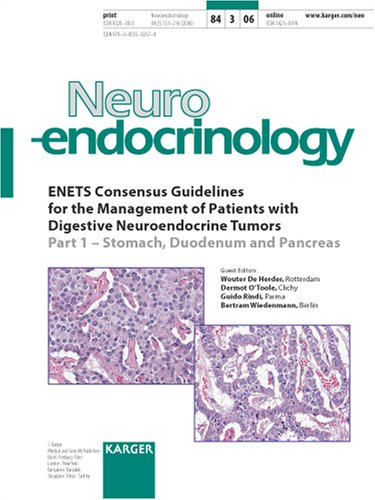 Enets Consensus Guidelines For The Management Of Patients With Digestive Neuroendocrine Tumors Part 1 Stomach Duodenum And Pancreas W W De Herder