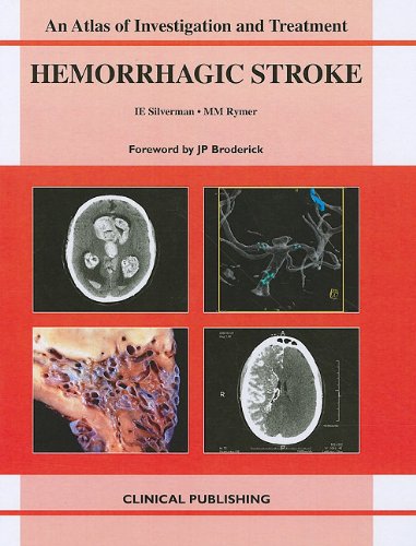 Hemorrhagic Stroke An Atlas Of Investigation And Treatment Atlas Of Assessment Diagnosis And Management 1st Edition Isaac E
