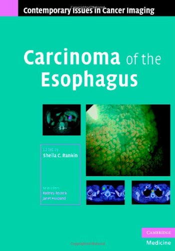 Carcinoma Of The Esophagus Contemporary Issues In Cancer Imaging 1st Edition Sheila C Rankin