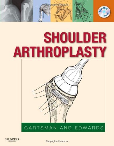 Shoulder Arthroplasty 1 Hardvd Gary M Gartsman Md T Bradley Edwards Md