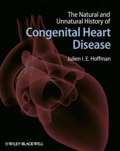 The Natural And Unnatural History Of Congenital Heart Disease 1st Edition Julien I E Hoffman
