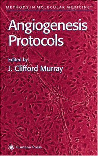 Angiogenesis Protocols Methods In Molecular Medicine 1st Edition J Clifford Murray