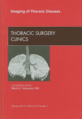Imaging Of Thoracic Diseases An Issue Of Thoracic Surgery Clinics The Clinics Surgery Mark K Ferguson Md