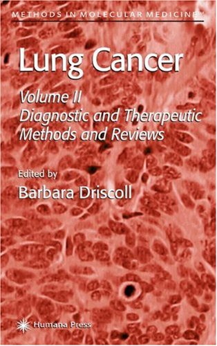 Lung Cancer Vol 2 Diagnostic And Therapeutic Methods And Reviews Methods In Molecular Medicine 1st Edition Barbara Driscoll