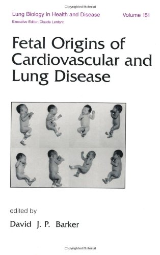 Lung Biology In Health Disease Volume 151 Fetal Origins Of Cardiovascular And Lung Disease 1st David J Barker