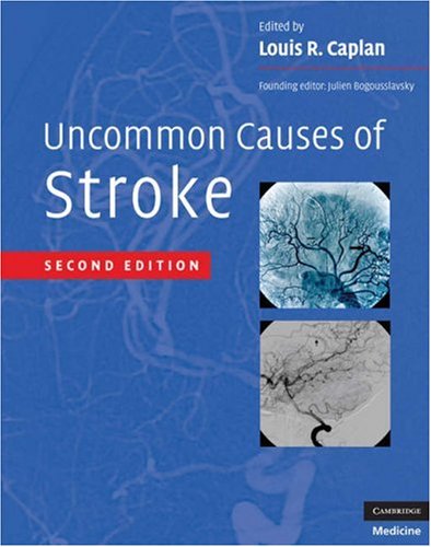 Uncommon Causes Of Stroke 2nd Edition 2nd Edition Louis R Caplan