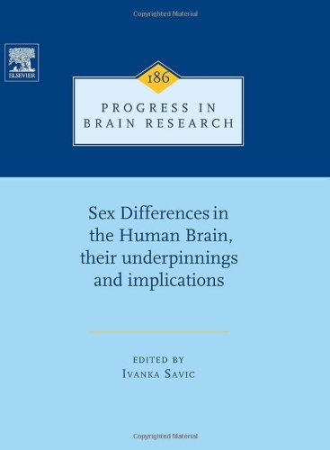 Sex Differences In The Human Brain Their Underpinnings And Implications 1st Edition Ivanka Savic