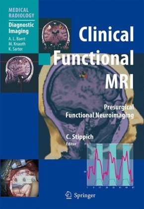 Clinical Functional Mri Presurgical Functional Neuroimaging Medical Radiology Diagnostic Imaging 1st Edition Christoph Stippich