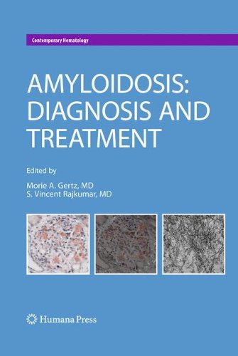 Amyloidosis Diagnosis And Treatment 1st Edition Douglas J Martin Bs