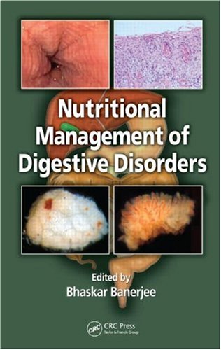 Nutritional Management Of Digestive Disorders Banerjee B Ed