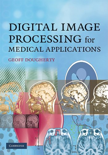 Digital Image Processing For Medical Applications Draft Dougherty G