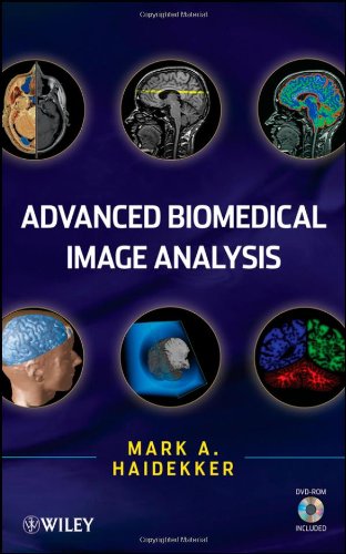 Advanced Biomedical Image Analysis 1st Edition Haidekker M