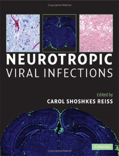 Neurotropic Viral Infections Reiss Cs Ed