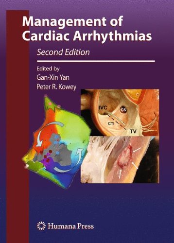 Management Of Cardiac Arrhythmias 2nd Edition David J Callans Md