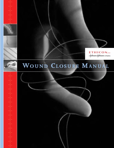 Wound Closure Manual Ethicon