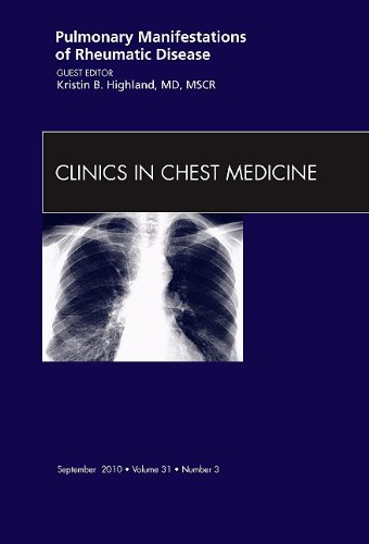 Pulmonary Manifestations Of Rheumatic Disease An Issue Of Clinics In Chest Medicine The Clinics Internal Medicine 1st Edition Kristin B Highland Md Mscr