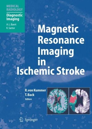 Magnetic Resonance Imaging In Ischemic Stroke 1st Edition Rdiger Von Kummer