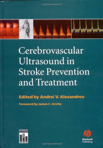 Cerebrovascular Ultrasound In Stroke Prevention And Treatment 1st Edition Andrei V Alexandrov