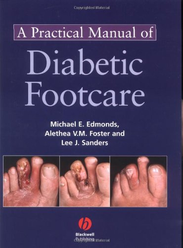 A Practical Manual Of Diabetic Foot Care 1st Edition Michael E Edmonds