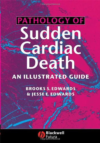 Pathology Of Sudden Cardiac Death An Illustrated Guide 1st Edition Brooks S Edwards