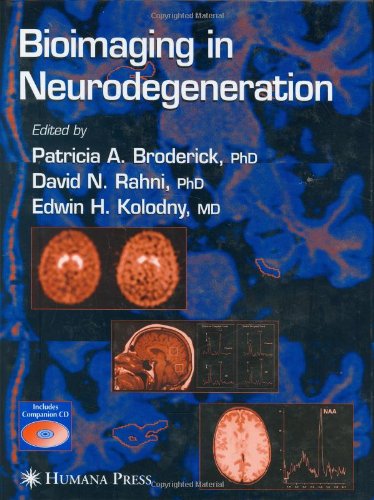 Bioimaging In Neurodegeneration 1st Edition Patricia A Broderick
