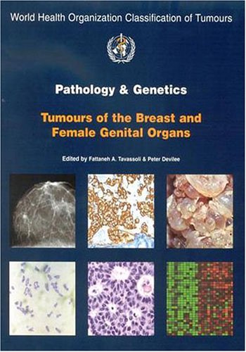 World Health Organization Tumours Of The Breast And Female Genital Organs Who Iarc Classification Of Tumours Iarc Who Classification Of Tumours 1st Edition Fattaneh A Tavassoli