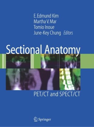 Sectional Anatomy Pet Ct And Spect Ct 1st Edition Edmund Kim