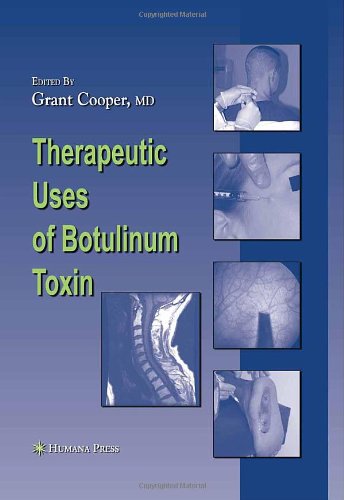 Therapeutic Uses Of Botulinum Toxin 1st Edition Grant C Cooper