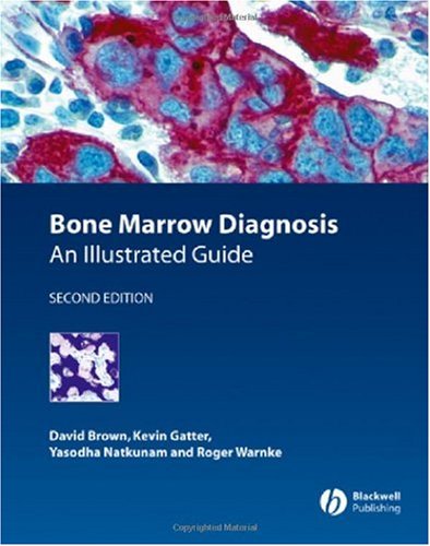 Bone Marrow Diagnosis An Illustrated Guide 2nd Edition 2nd Edition David Brown