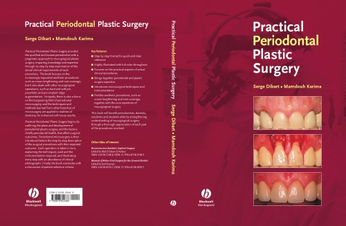 Practical Periodontal Plastic Surgery Serge Dibart Mamdouh Karima
