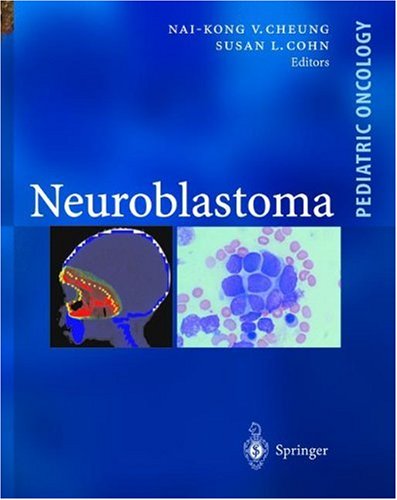 Neuroblastoma 1st Edition Naikong V Cheung Susan L Cohn