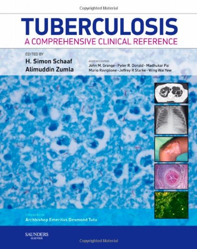 Tuberculosis A Comprehensive Clinical Reference 1st Edition H Simon Schaaf Mbchbstellenbosch Mmed Paedstellenbosch Dcmstellenbosch Md Paedstellenbosch
