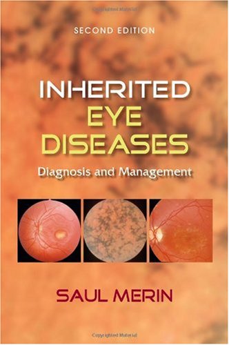 Inherited Eye Diseases Diagnosis And Management 2nd Edition Saul Merin
