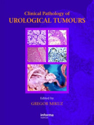Clinical Pathology Of Urological Tumours 1st Edition Mikuz Gregor