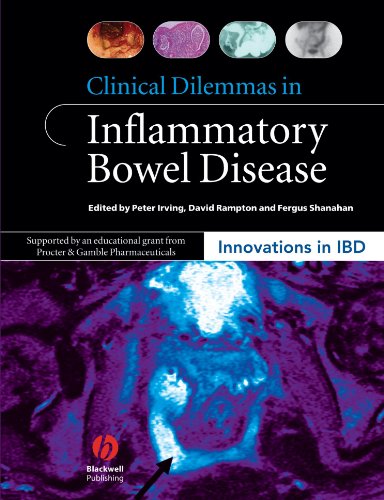 Clinical Dilemmas In Inflammatory Bowel Disease 1st Edition Peter Irving