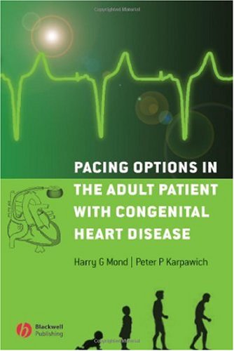 Pacing Options In The Adult Patient With Congenital Heart Disease 1st Edition Harry G Mond