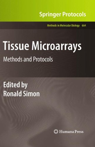 Tissue Microarrays Methods And Protocols 1st Edition Ronald Simon Auth