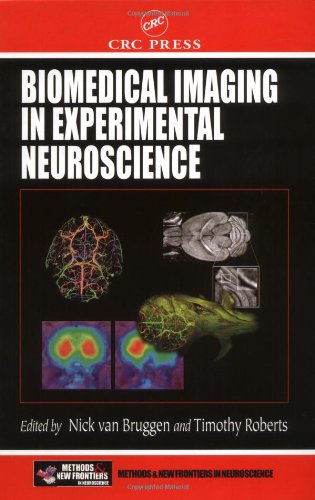 Biomedical Imaging In Experimental Neuroscience Frontiers In Neuroscience 1st Edition Nick Van Bruggen