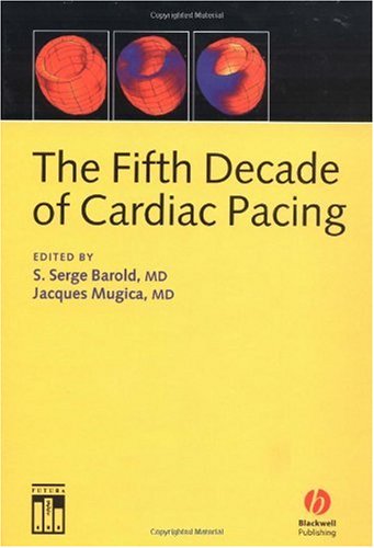 The Fifth Decade Of Cardiac Pacing 1st Edition S Serge Barold