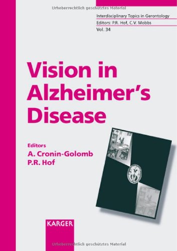 Vision In Alzheimers Disease 1st Edition Alice Croningolomb