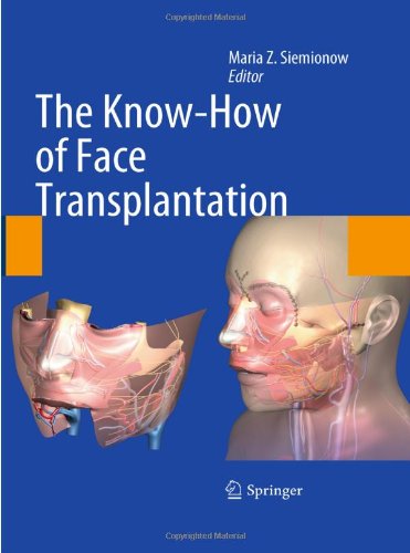 The Knowhow Of Face Transplantation 1st Edition Maria Z Siemionow